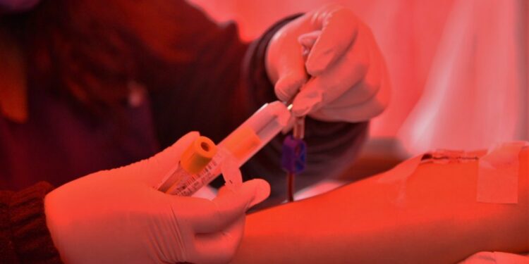 EN CUARENTENA, SE MANTUVO LA DEMANDA DE COMPONENTES SANGUÍNEOS