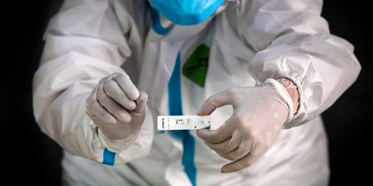 APROBARON EL PRIMER TEST RÁPIDO PARA DETECTAR CORONAVIRUS EN CASA
