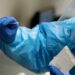 Covid-19: se registraron 87 casos positivos, 101 pacientes dados de alta y 3 fallecidos