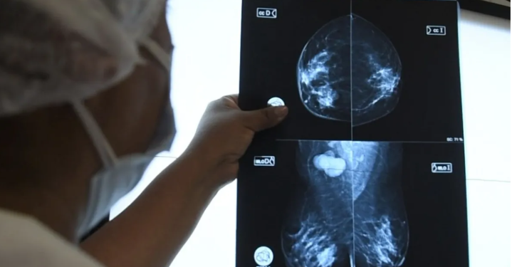 Mamografías a disposición en el Hospital de Humahuaca