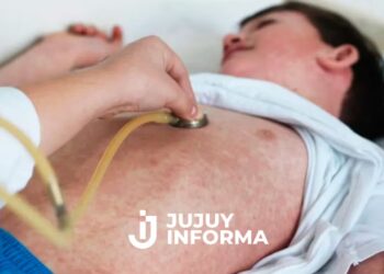 El Ministerio de Salud emitió una alerta por la circulación en varias provincias de una familia con sarampión
